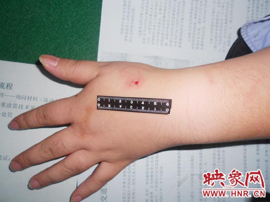 為幫助無證駕駛的朋友逃避處罰，新鄉(xiāng)的王某竟對(duì)執(zhí)勤民警大打出手，還將一名民警的手臂咬傷