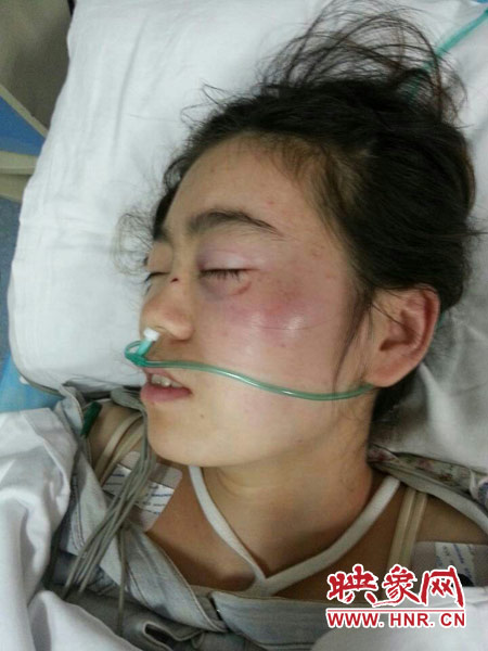 9月10日晚,被暴打的小陳出現(xiàn)了間歇性昏迷,被送進了省人民醫(yī)院。