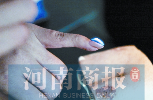 將指甲油涂在指甲上，靠近火焰時(shí)被引燃了