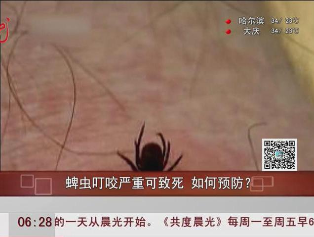 蜱蟲叮咬嚴(yán)重可致死如何預(yù)防？